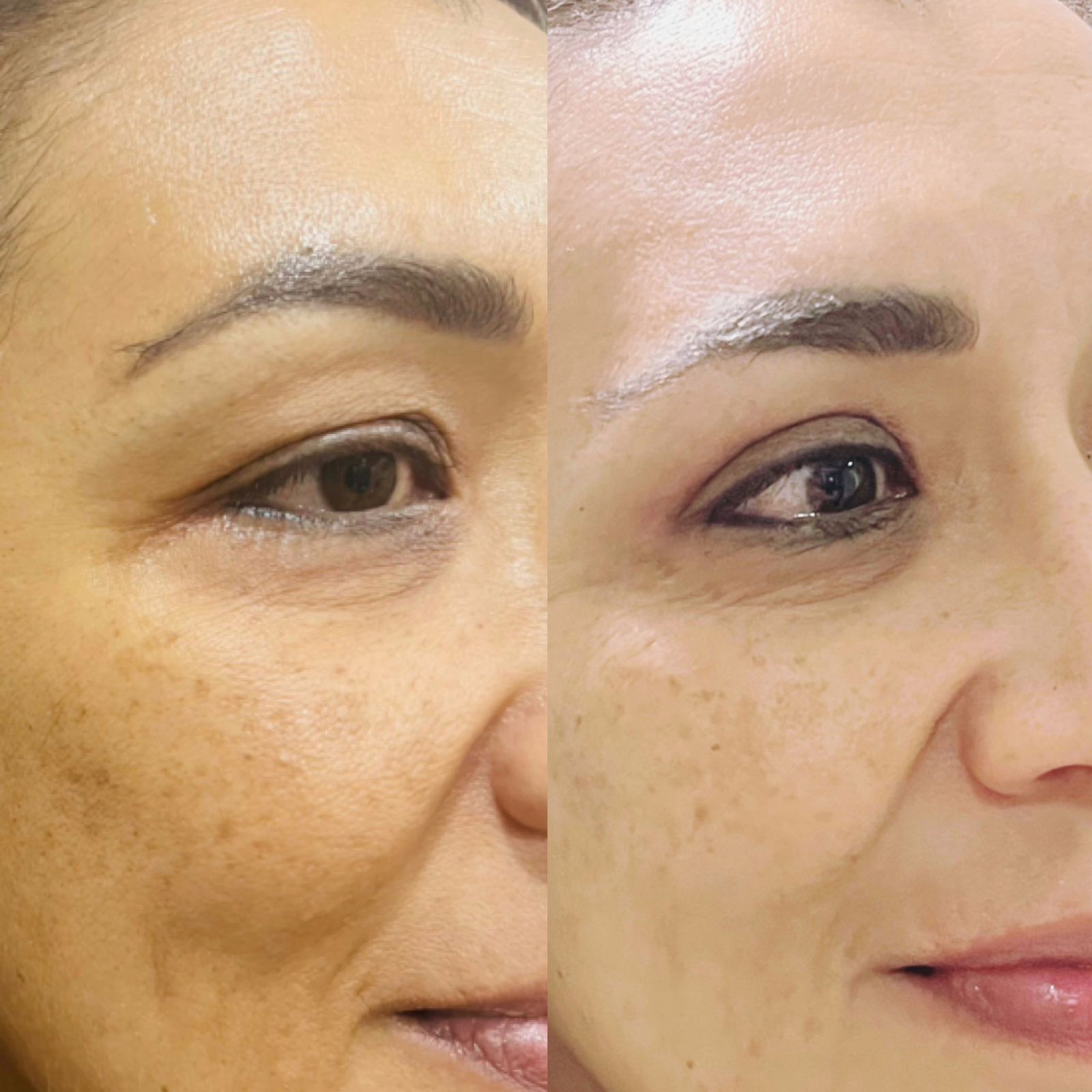 otoplastia reconstructiva